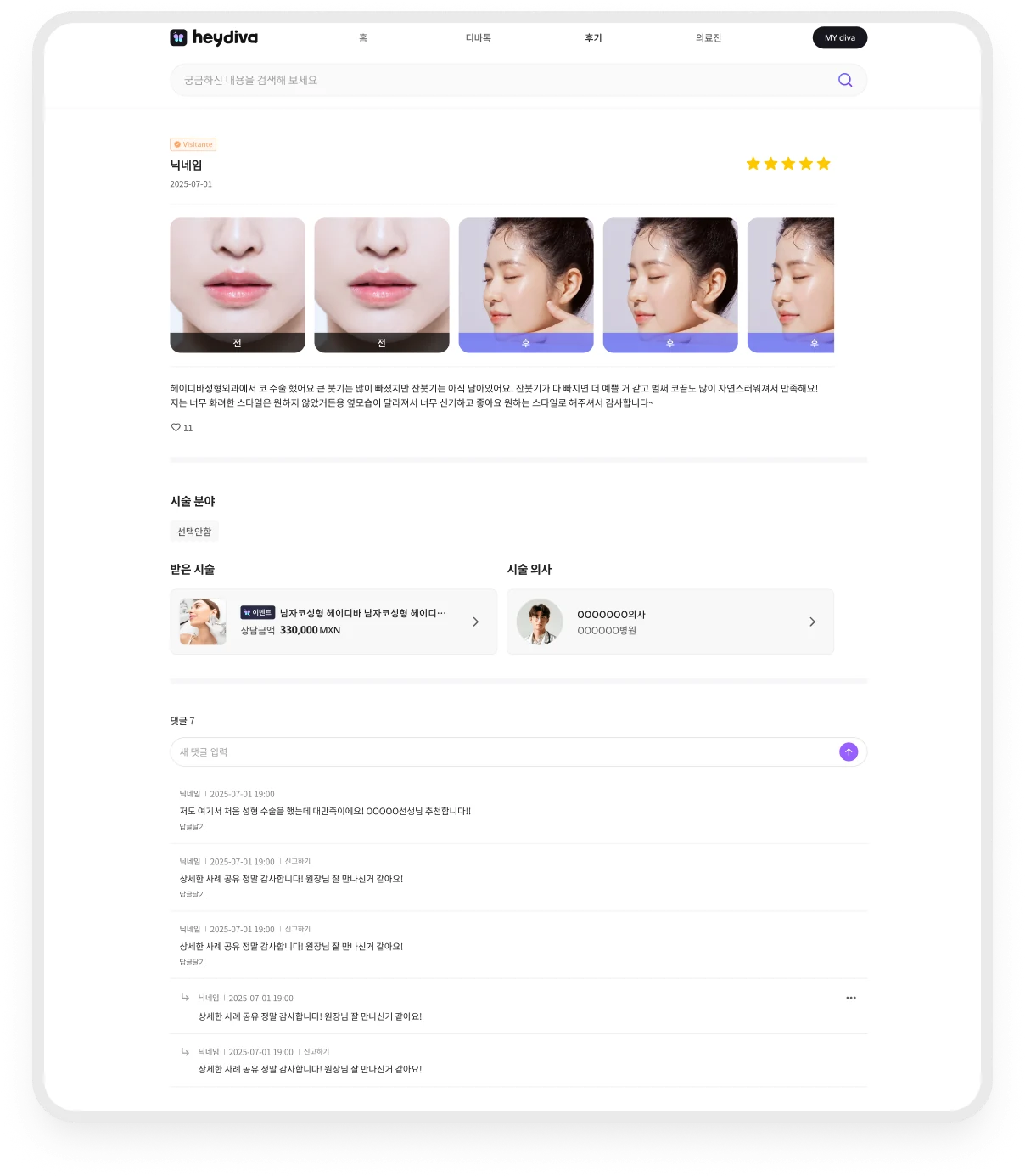 시술 전후 사진, 후기, 받은 시술과 의사 정보, 댓글을 함께 보여주는 화면